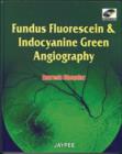 Fundus Fluorescien and Indocyanine Green Angiography - Book