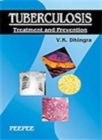 Tuberculosis : Treatment and Prevention Volume 1 - Book