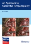 An Approach to Successful Tympanoplasty - eBook