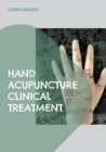 Hand Acupuncture : Clinical Treatment - Book