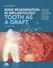 Bone regeneration in implantology - tooth as a graft - Book