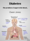 Diabetes : The Problem Of Sugar In The Blood... - eBook