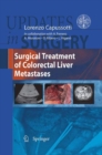 Surgical Treatment of Colorectal Liver Metastases - eBook
