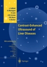 Contrast-Enhanced Ultrasound of Liver Diseases - Book