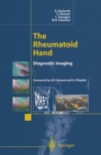 The Rheumatoid Hand : Diagnostic Imaging - eBook