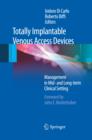 Totally Implantable Venous Access Devices - eBook