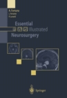 Essential Illustrated Neurosurgery - eBook