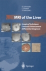 MRI of the Liver : Imaging Techniques Contrast Enhancement Differential Diagnosis - eBook