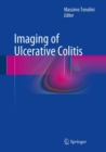 Imaging of Ulcerative Colitis - Book