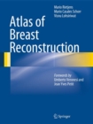 Atlas of Breast Reconstruction - Book