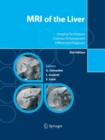MRI of the Liver : Imaging Techniques, Contrast Enhancement, Differential Diagnosis - Book