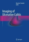 Imaging of Ulcerative Colitis - Book