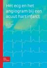 Het ECG En Het Angiogram Bij Een Acuut Hartinfarct - Book