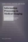 Information Processing in Medical Imaging - Book