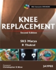 Knee Replacement - Book