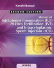Manual of Intrauterine Insemination (IUI), In Vitro Fertilization (IVF) and Intracytoplasmic Sperm Injection (ICSI) - Book