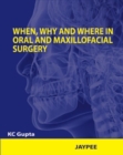 When, Why and Where in Oral and Maxillofacial Surgery - Book