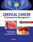 Cervical Cancer : Contemporary Management - Book