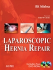 Laparoscopic Hernia Repair - Book