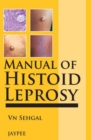 Manual of Histoid Leprosy - Book
