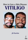 How to Cure a Skin Disease: Vitiligo - Book