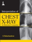 Interpretation of Chest X-Ray : An Illustrated Companion - Book