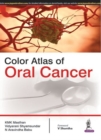 Color Atlas of Oral Cancer - Book