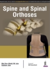 Spine and Spinal Orthosis - Book