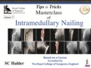 Tips and Tricks: Masterclass of Intramedullary Nailing : Three Volume Set - Book