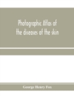 Photographic atlas of the diseases of the skin; A Series of Eighty Plates, Comprising more than One Hundred Illustrations, with Descriptive text, and a Treatise on Cutaneous Therapeutics - Book