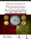 Practical Handbook of Fluorescein Angiography : Posterior Pole and Retinal Periphery - Book