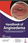 Handbook of Angioedema - Book