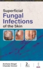Superficial Fungal Infections of the Skin - Book