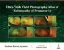 Ultra-Wide Field Photography Atlas of Retinopathy of Prematurity - Book
