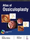 Atlas of Ossiculoplasty - Book