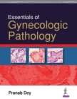 Essentials of Gynecologic Pathology - Book