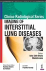 Clinico Radiological Series: Imaging of Interstitial Lung Diseases - Book