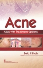 Acne Atlas with Treatment Options - Book