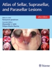 Atlas of Sellar, Suprasellar, and Parasellar Lesions - Book