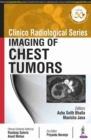 Clinico Radiological Series: Imaging of Chest Tumors - Book