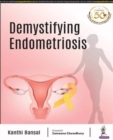 Demystifying Endometriosis - Book