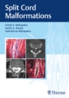 Split Cord Malformations - eBook