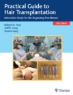 Practical Guide to Hair Transplantation : Interactive Study for the Beginning Practitioner - eBook