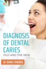 Diagnosis of Dental Caries-Old and the New - Book
