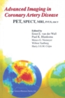 Advanced Imaging in Coronary Artery Disease : PET, SPECT, MRI, IVUS, EBCT - eBook