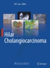 Hilar Cholangiocarcinoma - eBook