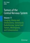 Tumors of the Central Nervous System, Volume 11 : Pineal, Pituitary, and Spinal Tumors - Book