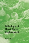 Pathology of Heart Valve Replacement - eBook
