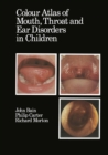 Colour Atlas of Mouth, Throat and Ear Disorders in Children - eBook