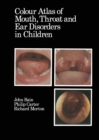 Colour Atlas of Mouth, Throat and Ear Disorders in Children - Book